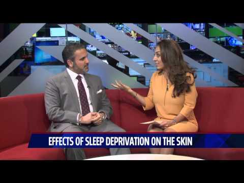how to relieve sleep deprivation