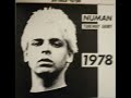 Gary Numan/Tubeway Army This is My Life & Basic J