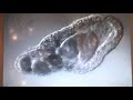 Amoeba eats two paramecia (Amoeba's lunch) - YouTube