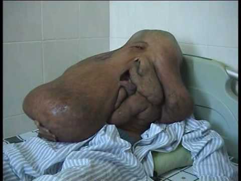 More about krooked mike anderson More about krooked mike anderson