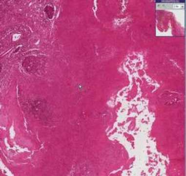 Histopathology ...