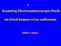 Electron Microscope images of plant cell particles in urine sediment.mp4