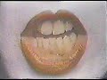 teledysk, klip, Kiss,- Sure Know Something