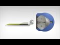 Leksell Gamma Knife 4C Gamma Knife Treatment