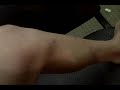 Dirt Bike Scars
