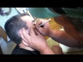 Joe's cyst