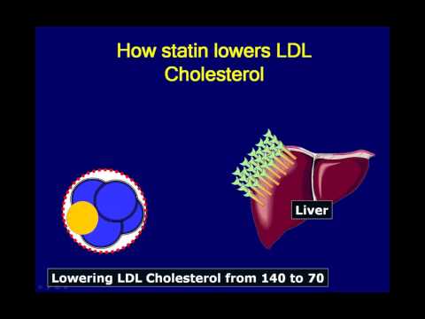 how to treat ldl cholesterol