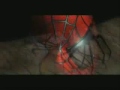 Search Video