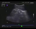 O boc�o de Beatriz