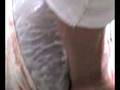 autopsia