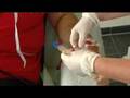 Dialyse op boerderijcamping
