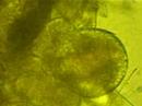 Paramecium bursaria? I\
