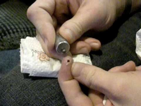 how to remove a bb from under skin