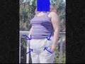 fupa