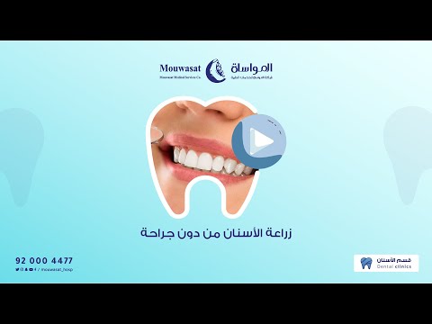  Dental implants without surgery, Mowasat Hospital, Dammam