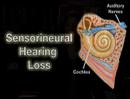 Understanding the Hearing Impaired (Helping #4)