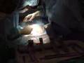 my 2nd cesarian operation