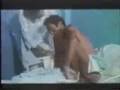 rabies_1
