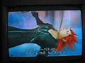 videos de Axel's Dead