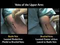 Ultrasound-Guided Peripheral Venous Access - Part 1