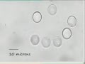 Optical Tweezers