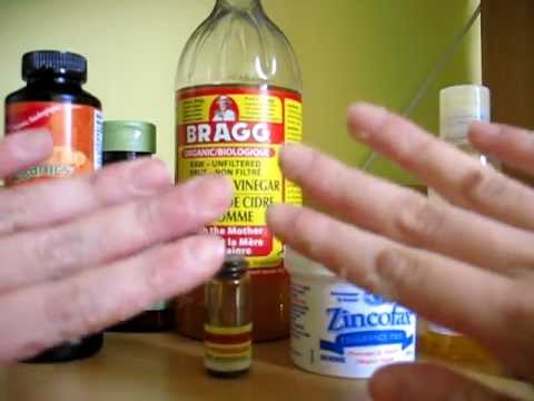 how to cure dyshidrosis