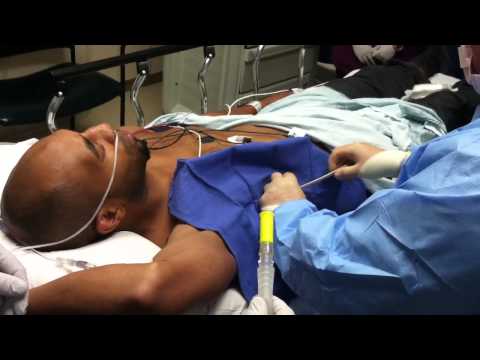 how to relieve pneumothorax