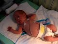 Emma - 36 weeks - NICU pt2