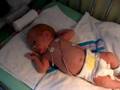 Emma - 36 weeks - NICU pt2