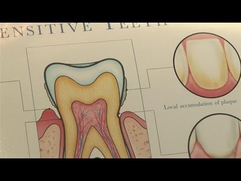 how to cure sensitive teeth