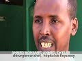 n 2007, mogadiscio a �t� le th��tre d'affrontements intenses opposant les forces du gouvernement f�d�ral de transition, soutenues par l'arm�e �thiopienne, et les combattants des tribunaux islamiques. les h�pitaux sont utilis�s au maximum de leurs capacit�s. les chirurgiens des h�pitaux de madina et keysaney ont trait� plus de 4000 bless�s de guerre, deux fois plus qu'en 2006. ce film montre le combat extraordinaire des chirurgiens pour la vie au milieu de la guerre.