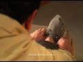 PSA: Diabetic Neuropathy (30 sec)