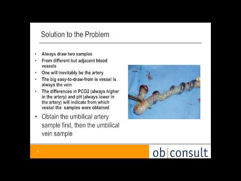 how to obtain umbilical cord blood gas