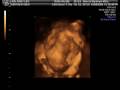 30 week 4d ultrasound