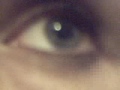 my eyes burn