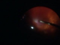 video9.flv