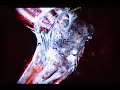 Blitz: The League II Injury (Torn MCL)