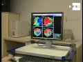 Técnica pionera regenera tejidos cardÃacos inyectando células madre-