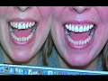 Cosmetic Dentist London