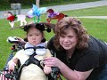 Spinal Muscular Atrophy -SMA/In Loving Memory of Lily Spinal Muscular Atrophy -SMA/In Loving Memory of Lily