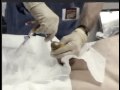 Male-Urethral-Cathet