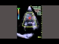 Cardiac Amyloidosis - Pocket Ultrasound
