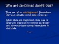 A Forgotten Cancer Sarcoma