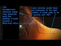Deus Ex 3 Trailer - Fetus Analysis