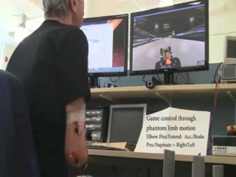 how to relieve phantom limb pain