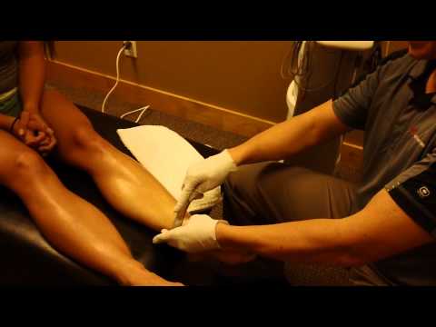 how to cure shin splints