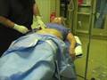 Liposuction Procedure