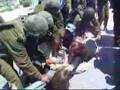 Activists Attacked After Opening Razor Wire Fence
