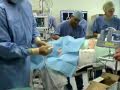 cannulation