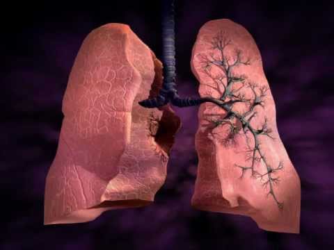 how to treat idiopathic pulmonary fibrosis